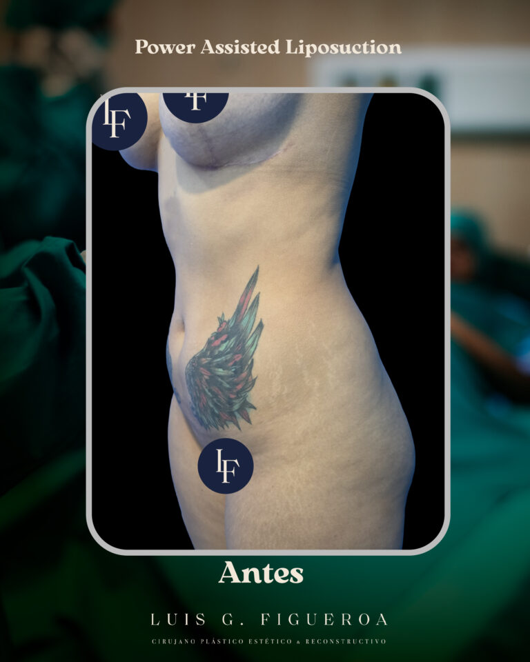 LUISF-10 copia 3 (1)